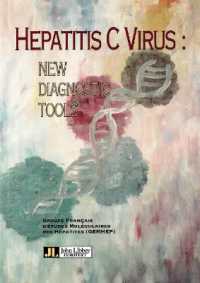 Hepatitis C Virus : New Diagnostic Tools