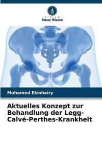 Aktuelles Konzept zur Behandlung der Legg-Calvé-Perthes-Krankheit （2025. 64 S. 220 mm）