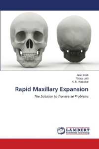 Rapid Maxillary Expansion : The Solution to Transverse Problems （2022. 116 S. 220 mm）