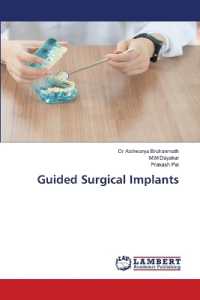 Guided Surgical Implants