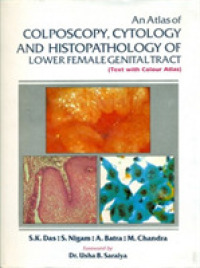 An Atlas of Colposcopy, Cytology & Histopathology of Lower Female Genital Tract : Text with Colour Atlas