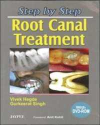 Step by Step: Root Canal Treatment (Step by Step)
