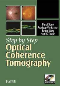 Step by Step: Optical Coherence Tomography (Step by Step)