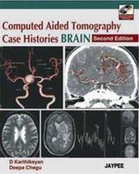 Computed Aided Tomography Case Histories Brain （2ND）