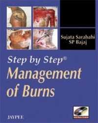 Step by Step: Management of Burns (Step by Step)