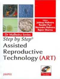 Step by Step: Assisted Reproductive Technology (ART) (Step by Step)