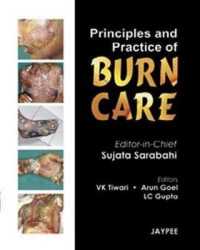 Principles and Practice of Burn Care -- Hardback （New ed）