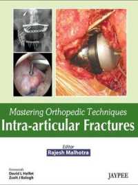 Mastering Orthopedic Techniques: Intra-Articular Fractures