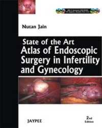 State-of-the-Art Atlas of Endoscopic Surgery in Infertility and Gynecology （2ND）