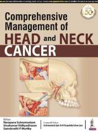 Comprehensive Management of Head and Neck Cancer -- Paperback / softback