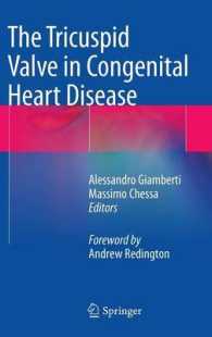 The Tricuspid Valve in Congenital Heart Disease （2014）