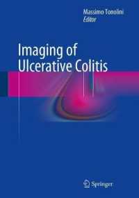 Imaging of Ulcerative Colitis （2014）