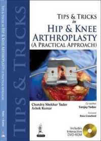 Tips and Tricks in Hip and Knee Arthroplasty : (A Practical Approach)