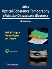 Atlas Optical Coherence Tomography of Macular Diseases and Glaucoma （4TH）