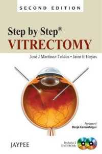 Step by Step: Vitrectomy (Step by Step) （2ND）