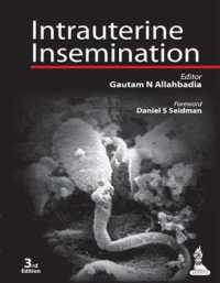 Intrauterine Insemination （2ND）