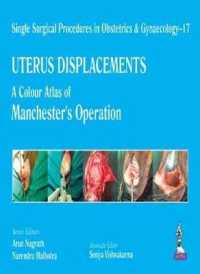 Single Surgical Procedures in Obstetrics and Gynaecology - 17 - UTERUS DISPLACEMENTS : A Colour Atlas of Manchester's Operation