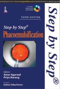 Step by Step Phacoemulsification （3RD）