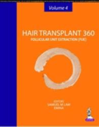 Hair Transplant 360 : Follicular Unit Extraction (Hair Transplant 360)