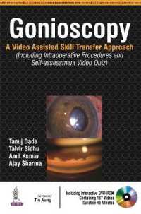 Gonioscopy : A Video Assisted Skill Transfer Approach