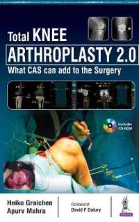 Total Knee Arthroplasty 2.0 : What CAS can add to the Surgery