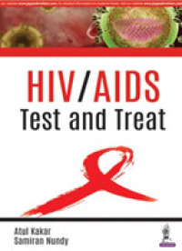 HIV / AIDS : Test and Treat