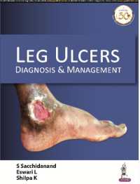 Leg Ulcers : Diagnosis & Management