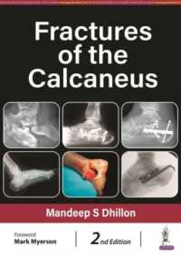 Fractures of the Calcaneus （2ND）