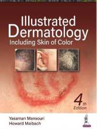 Illustrated Dermatology : Including Skin of Colour （4TH）