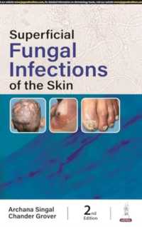 Superficial Fungal Infections of the Skin （2ND）