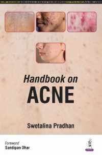 Handbook on Acne