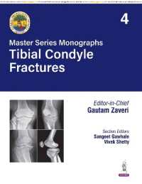 Master Series Monographs: Tibial Condyle Fractures : Volume 4