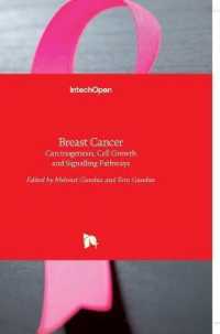 Breast Cancer : Carcinogenesis, Cell Growth and Signalling Pathways