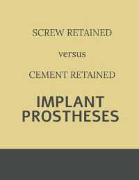 Implant retained Prostheses : Screw versus Cement