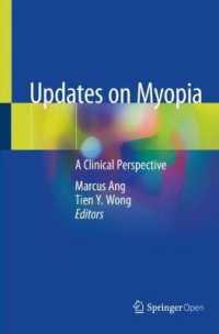 Updates on Myopia : A Clinical Perspective