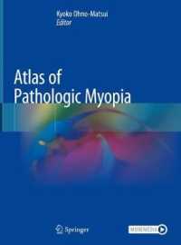 大野京子（東京医科歯科大学）編／病理的近視アトラス<br>Atlas of Pathologic Myopia