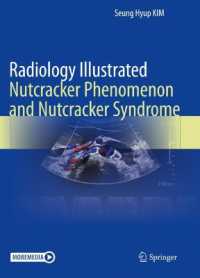 Radiology Illustrated: Nutcracker Phenomenon and Nutcracker Syndrome (Radiology Illustrated)