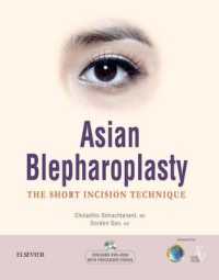Asian Blepharoplasty - the Short Incision Technique