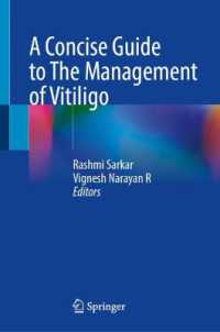 A Concise Guide to Management of Vitiligo