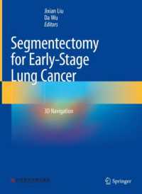 Segmentectomy for Early-Stage Lung Cancer : 3D Navigation