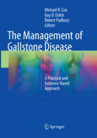 The Management of Gallstone Disease : A Practical and Evidence-Based Approach
