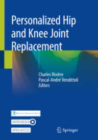 Personalized Hip and Knee Joint Replacement （2020）