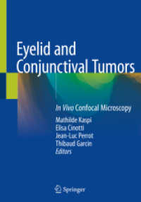 Eyelid and Conjunctival Tumors : In Vivo Confocal Microscopy