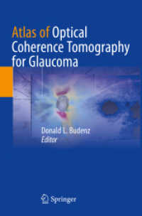 Atlas of Optical Coherence Tomography for Glaucoma （1st ed. 2020. 2021. x, 204 S. X, 204 p. 235 mm）