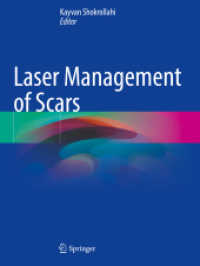 Laser Management of Scars