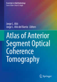 Atlas of Anterior Segment Optical Coherence Tomography (Essentials in Ophthalmology) （2021. xvi, 256 S. XVI, 256 p. 309 illus., 255 illus. in color. 254 mm）