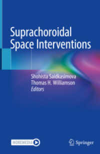 Suprachoroidal Space Interventions （1st ed. 2021. 2021. v, 166 S. V, 166 p. 78 illus., 62 illus. in color.）