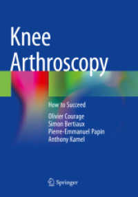 Knee Arthroscopy : How to Succeed （2021）