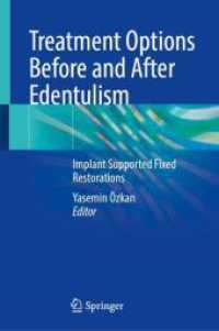 Treatment Options before and after Edentulism : Implant Supported Fixed Restorations