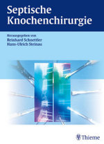Septische Knochenchirurgie （2004. IX, 302 S. m. 524 meist farb. Abb. 27,5 cm）